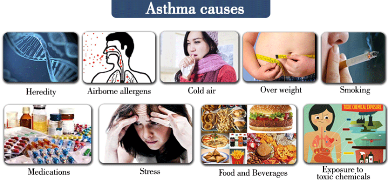 Asthma-causes.
