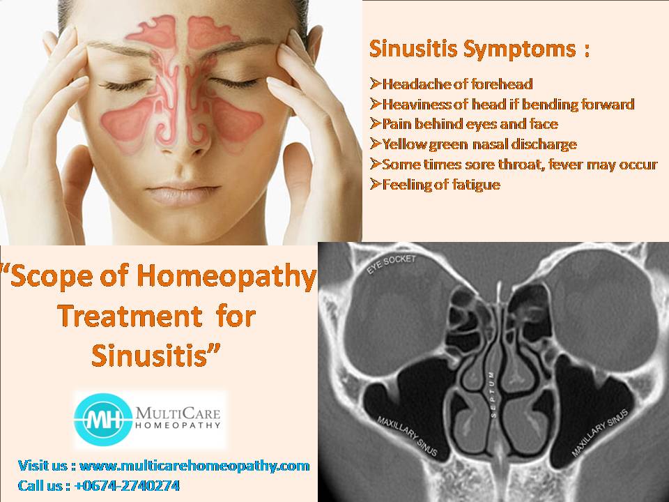 homeopathy for sinusitis