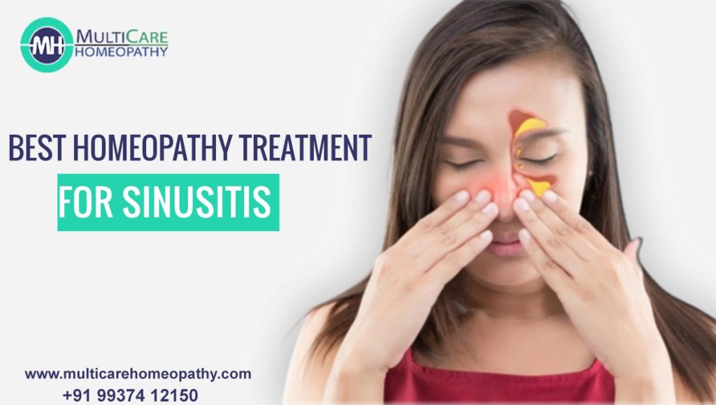 homeopathy treatment for Sinusitis,
